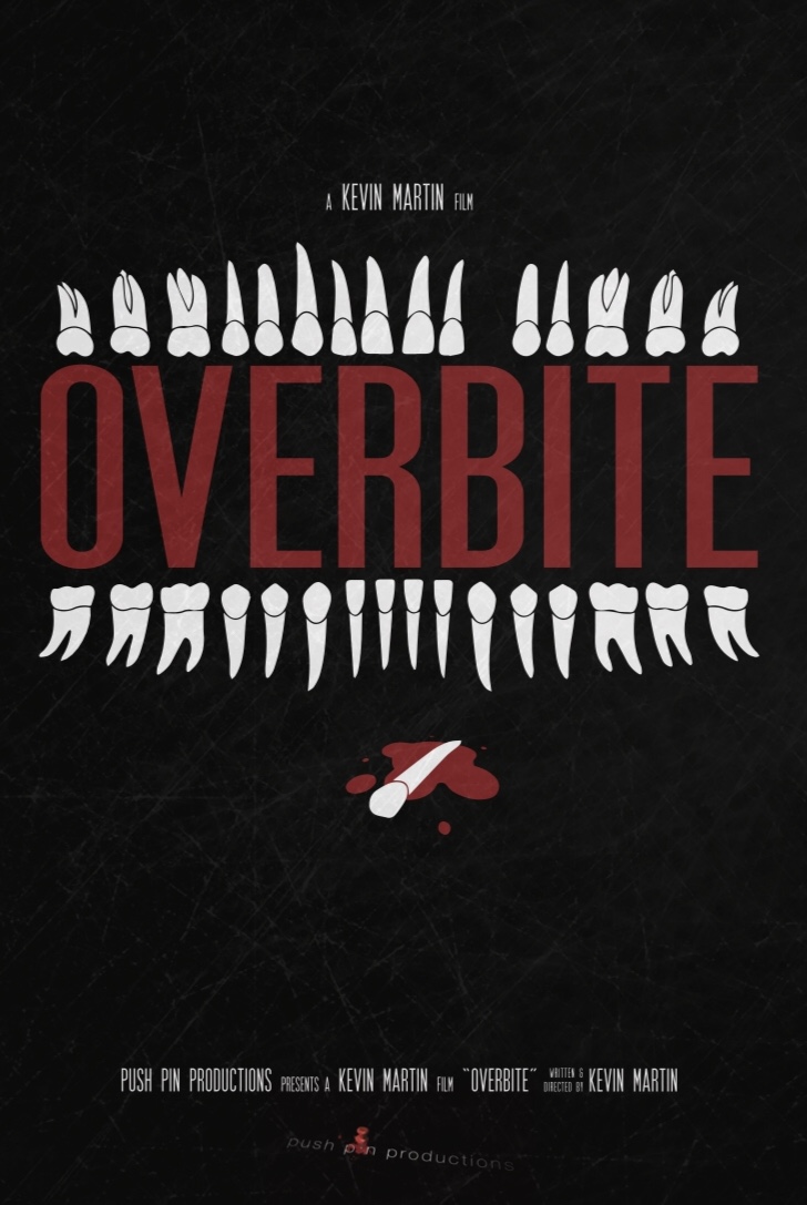 Overbite 