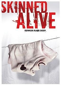 SKINNED ALIVE                     