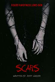 Scars